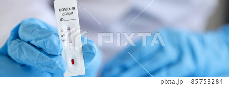 Doctor wearing disposable gloves holds positive PCR test for coronavirus infection 85753284