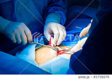 Two pairs of hands of surgeons in xing operate on a person. Two pairs of hands of surgeons in xing operate on a person. 85756070