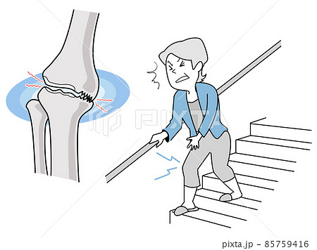 膝関節の痛み-老化で骨が衰える 85759416