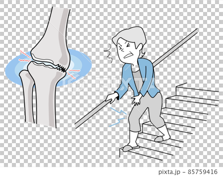膝関節の痛み-老化で骨が衰える 85759416
