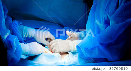 Two pairs of hands of surgeons in xing operate on a person. 85760810