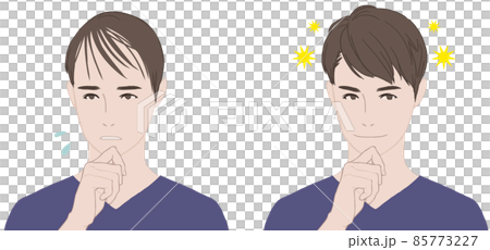薄毛に悩む男性とフサフサの男性 85773227