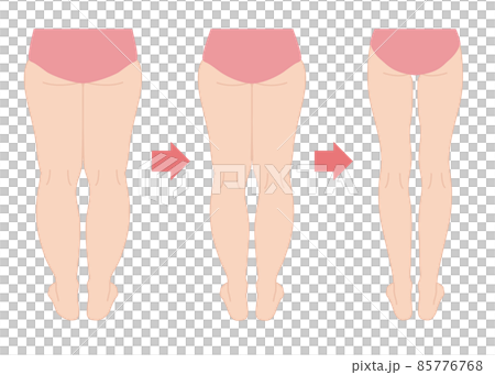 Progress of diet: thin legs (back) Progress of diet: thin legs (back) 85776768