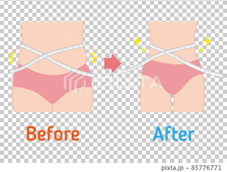 Diet before and after (neck) 85776771