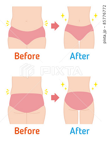 ダイエット ビフォーアフター(お腹とお尻) ダイエット ビフォーアフター(お腹とお尻) 85776772