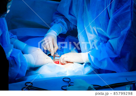 Hands of surgeons in white sterile gloves sew up the patient's skin Hands of surgeons in white sterile gloves sew up the patient's skin 85799298
