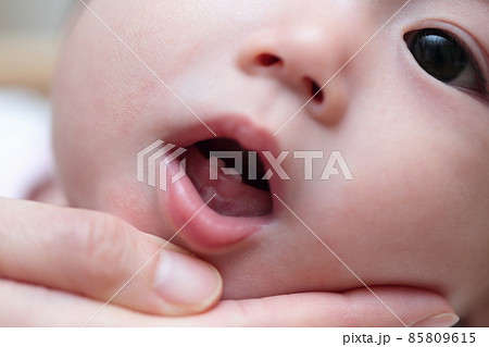 0歳の赤ちゃんに生えた乳歯 85809615