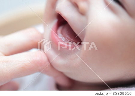 0歳の赤ちゃんに生えた乳歯 85809616