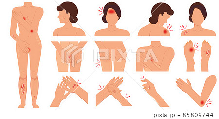 Pain in the body women parts physical injury flat set caused by illness or injury isolated on white background. 85809744