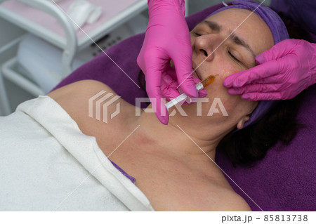 Applying the brightening serum with a syringe to reduce wrinkles and redness on the skin of the face Applying the brightening serum with a syringe to reduce wrinkles and redness on the skin of the face 85813738