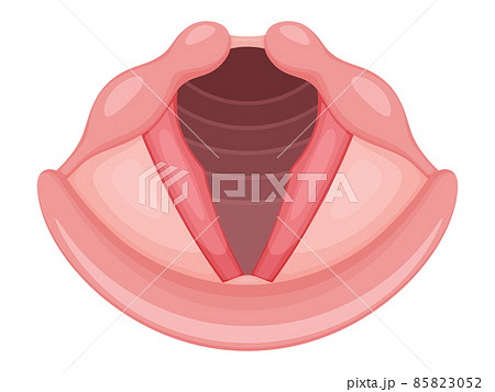 急性喉頭炎のイラスト 85823052