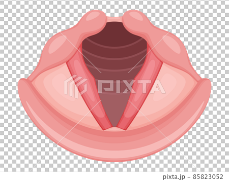 急性喉頭炎のイラスト 85823052