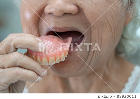 Asian senior or elderly old woman patient holding to use denture in nursing hospital ward, healthy strong medical concept Asian senior or elderly old woman patient holding to use denture in nursing hospital ward, healthy strong medical concept 85920011