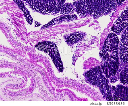 Animal tissue samples under the microscope in Lab. 85933986