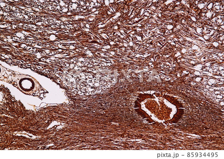 Motor Neuron and nerve cells under the microscope in Lab. 85934495