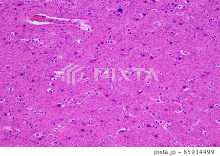 Motor Neuron and nerve cells under the microscope in Lab. 85934499