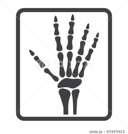 Hand X-ray line icon, medicine and healthcare, radiology sign vector graphics, a linear pattern on a white background, eps 10. Hand X-ray line icon, medicine and healthcare, radiology sign vector graphics, a linear pattern on a white background, eps 10. 85945923