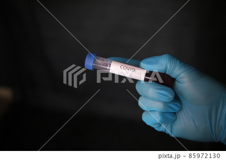 Closeup of microbiologist or medical worker hands with blue surgical gloves looking blood test result as positive for new rapidly spreading Coronavirus. Pandemic and epidemic COVID-19 Positive concept 85972130