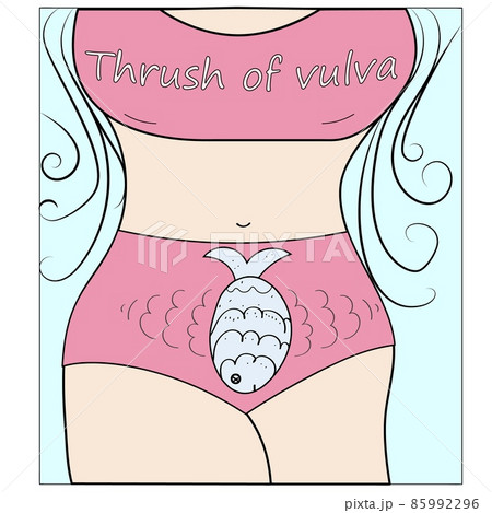 Vaginal thrush, candidiasis. Vaginal infection. Funny cartoon style illustration 85992296