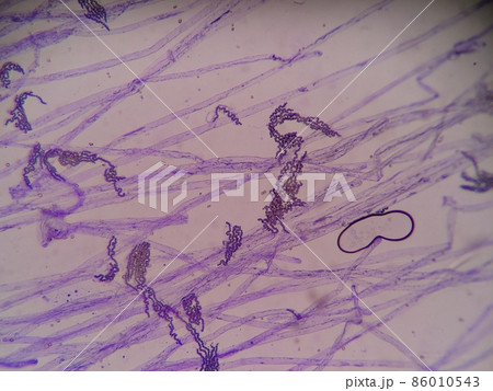 カビの菌糸と連鎖している胞子群 カビの菌糸と連鎖している胞子群 86010543