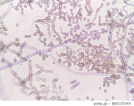 水から分離した菌の顕微鏡写真 水から分離した菌の顕微鏡写真 86010549