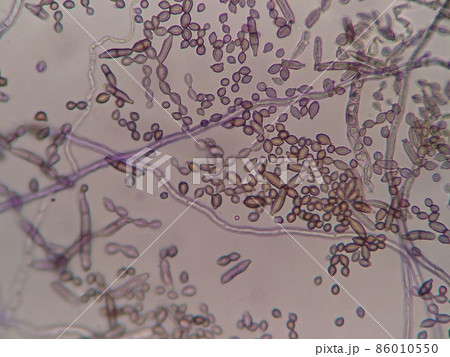 綺麗な胞子が観察できる微生物 86010550