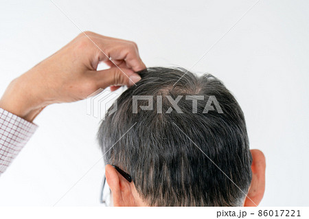 シニア男性 ヘアケア 薄毛 シニア男性 ヘアケア 薄毛 86017221