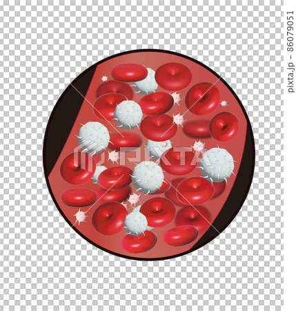 紅細胞 白細胞 血小板 紅細胞 白細胞 血小板 86079051