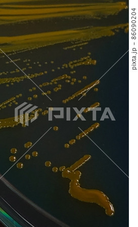 シングルコロニーの観察 シングルコロニーの観察 86090204