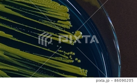 指についていた細菌の培養 指についていた細菌の培養 86090205