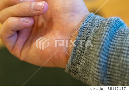 袖口の糸ほつれ 袖口の糸ほつれ 86112157