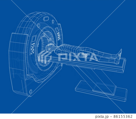 MRI machine scanning patient inside 86155362