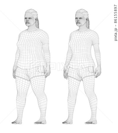 Fat and slim woman, before and after weight loss 86155897