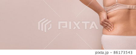 fat woman, fat side, plump, obese woman holding excessive fat on body sides, woman diet lifestyle concept 86173543