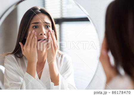 Skin Problems Concept. Unhappy Young Woman Looking At Mirror And Touching Face 86178470