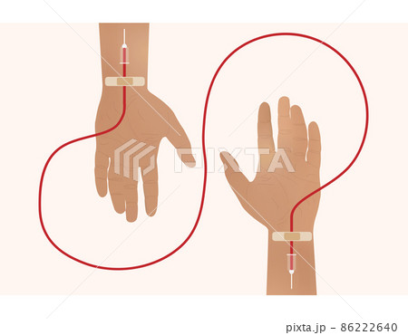 Blood donation. Hands raised up, sacrificing blood 86222640