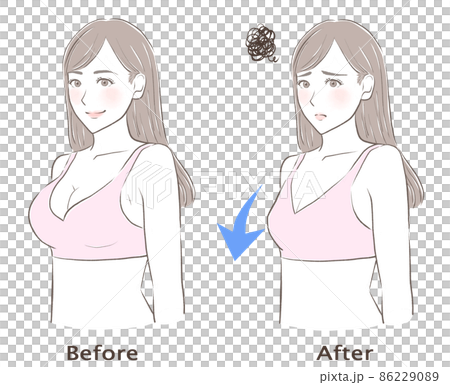 胸圍下降的女性 86229089