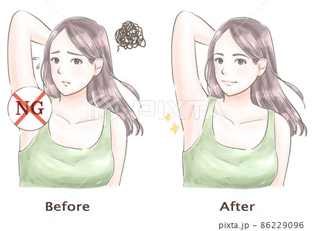 脇の悩みがなくなった女性　水彩風 86229096
