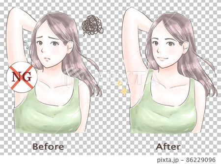 脇の悩みがなくなった女性　水彩風 86229096