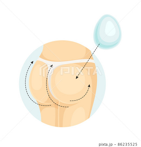 Female buttocks after correction of implants. Plastic surgery vector illustration 86235525