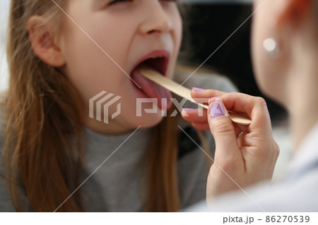 Girl open mouth for check up, hurting throat, pediatrician check with stick 86270539