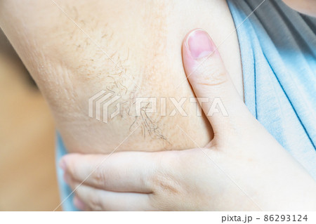 20代女性のワキ毛の写真。ムダ毛・美容・お手入れのイメージ。 20代女性のワキ毛の写真。ムダ毛・美容・お手入れのイメージ。 86293124