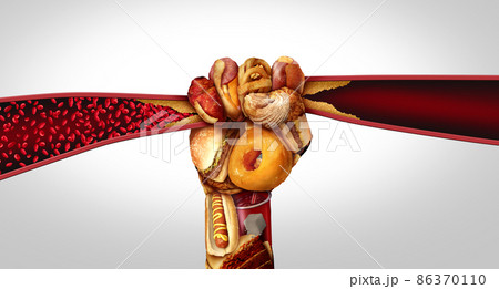 Artery Disease And Food Artery Disease And Food 86370110