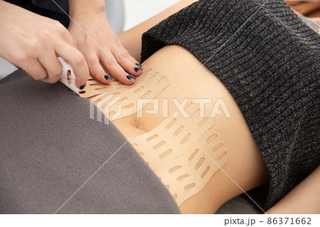Young caucasian girl with kinesiology tape on her belly. Young caucasian girl with kinesiology tape on her belly. 86371662