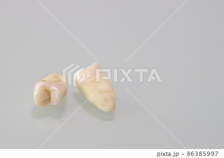 抜歯した歯 抜歯した歯 86385997