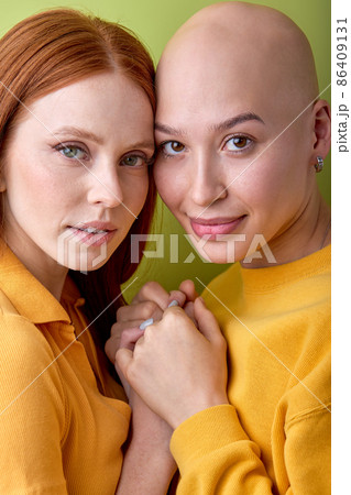 Close-up Portrait Of Two Caucasian Bald And Redhead Women Keeping Hands Together Close-up Portrait Of Two Caucasian Bald And Redhead Women Keeping Hands Together 86409131