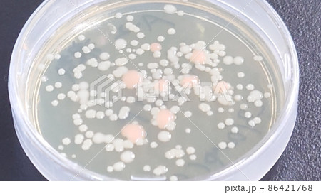 手のひらのばい菌培養シャーレ 手のひらのばい菌培養シャーレ 86421768