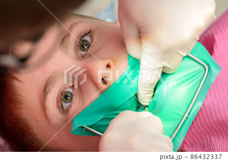 The dentist treats the child's tooth using a rubber dam. The dentist treats the child's tooth using a rubber dam. 86432337