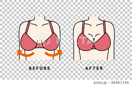 Bust foundation garment before and after - Stock Illustration