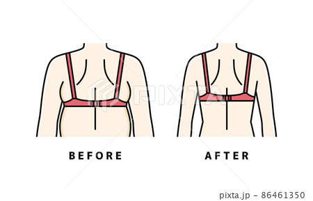 ダイエット 後ろ姿 脇のハミ肉 ダイエット 後ろ姿 脇のハミ肉 86461350